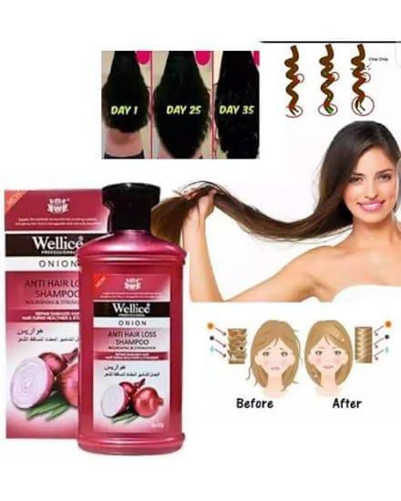 "Wellice Onion Anti Hair Loss Shampoo - Strengthening &amp; Nourishing Formula for Thicker, Fuller Hair